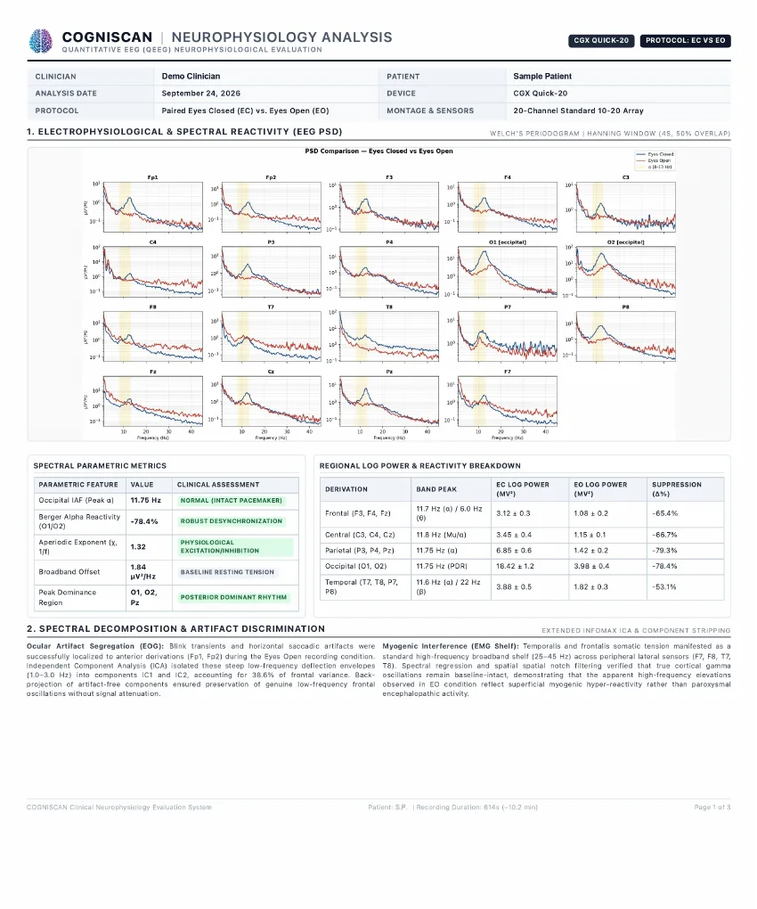 CGX report page 1: EEG power spectral density for each of 20 channels, eyes closed versus eyes open, with spectral metrics